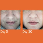 Youth Lab. Dark Spot Remover Serum Δραστικός Ορός Πρόληψης & Αποχρωματισμού των Κηλίδων, 30ml - Image 4