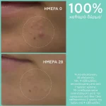 Apivita Just Bee Clear Purifying Cleansing Gel, Καθαριστικό Τζελ Προσώπου για Λιπαρή Επιδερμίδα ή με Τάση Ακμής 200ml - Image 2