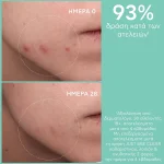Apivita Just Bee Clear Purifying Lotion Λοσιόν Σύσφιξης Πόρων, 200ml - Image 2