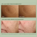 Origins Mega-Mushroom Dark Spot Corrector Serum Ορός Προσώπου κατά των Κηλίδων, 50ml - Image 2